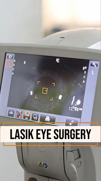 Say Goodbye to Glasses! 👓 LASIK Surgery at Smart Vision Eye Hospital