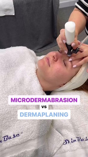 2.4K views | Microdermabrasion vs Dermaplaning Which is best for you?Find out on the blog... https://skinbase.co.uk/blog/microdermabrasion-vs-dermaplaning-which-is-right-for-you/ | SkinBase | Facebook