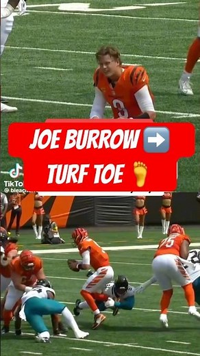 Joe Burrow’s Turf Toe Explained 🏈 | How Serious Is This Injury?