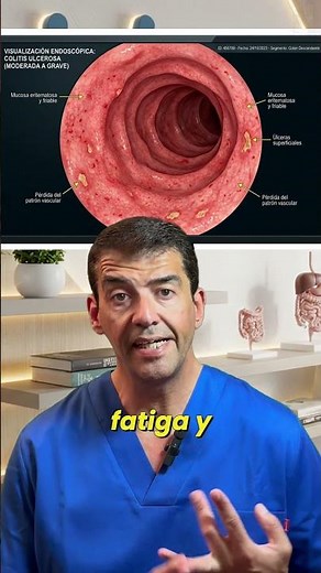 Ulcerative colitis, the inflammatory disease that doesn't forgive