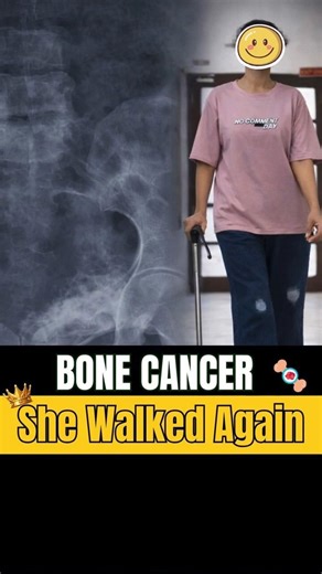 Life After Bone Cancer Surgery | Walking, Squatting & Independence – Dr Rajat Gupta