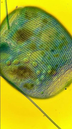 New Discoveries with the Globe | Euromex Delphi-X Observer with DIC