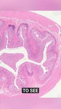 Histology Epithelium Intestine