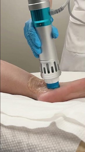 How Shockwave Therapy Relieves Ankle Pain (Close-Up)