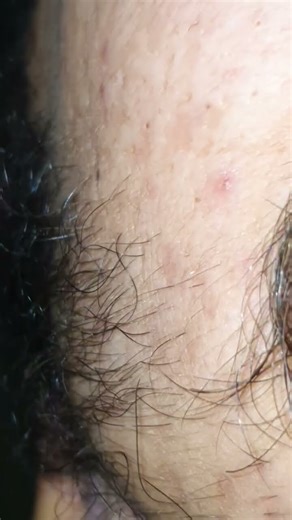 hair beard massage therapy #asmr #satisfying #beard #haircare #cute