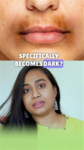 What causes Pigmentation Around Mouth #shortsfeed #skincaretelugu #bestbeautys