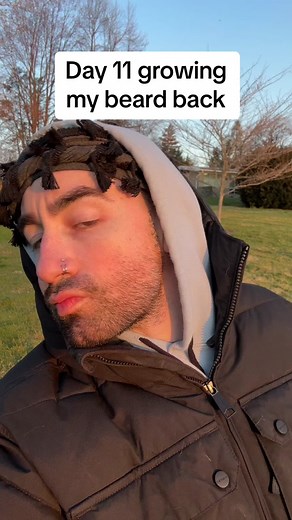 Day 11 Beard Growth Update | Minoxidil Progress | Day in My Life Vlog