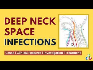 Deep Neck Space Infections