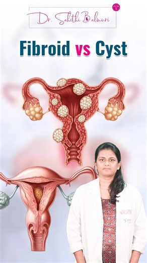 Sahithibalmuri | Fibroid or cyst — are they the same? Many women confuse the two. 📽️ Watch Dr. Sahithi Balmuri break down fibroids vs. cysts and understand... | Instagram