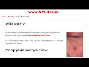 Pavúčikovité névy