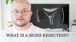 Understanding Mons Resection: A Comprehensive Guide