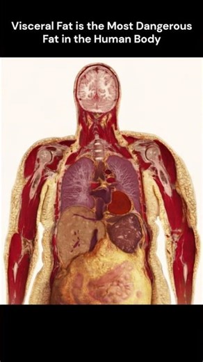 Visceral Fat क्यों बढ़ता है? शरीर की सबसे खतरनाक चर्बी का सच! 😨