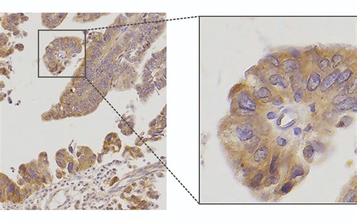 用AI作图——局部放大(Adobe Illustrator 科研必备技能第一弹)