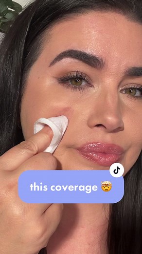 OTW to try this foundation RN. 🤯 #rosacea #fullcoverage #foundationhack #makeuptransformation