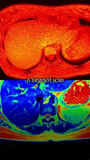 Full Body vs. Targeted Scan: What’s the Difference?