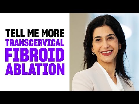 Tell Me More: Transcervical Fibroid Ablation