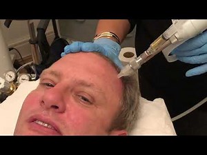 Med Jet the Needle Free injection system Treatment Video