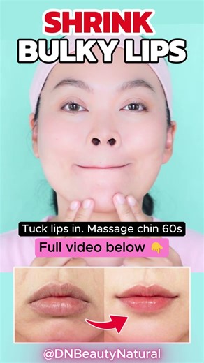 Shrink Bulky Lips 30-50% Naturally! 🧊 (No Filler)