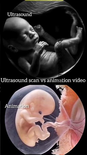 baby moving in mother womb #ultrasound #animation