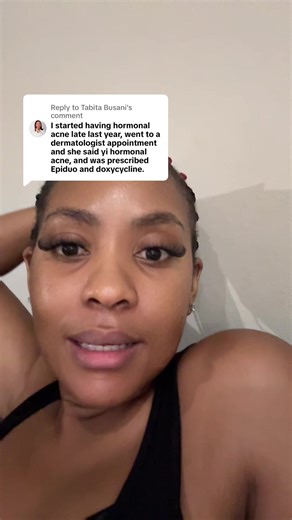 Understanding Doxycycline for Acne Treatment