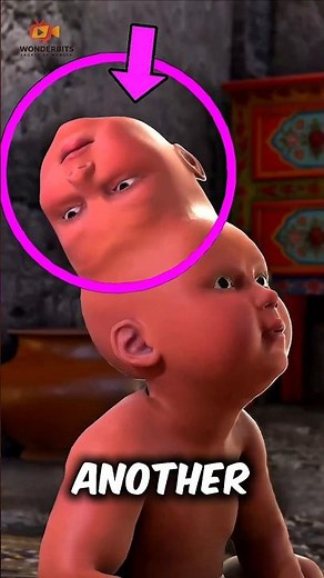 Born with Two Minds: The Baby Who Lived with His Twin on His Head‼️😱