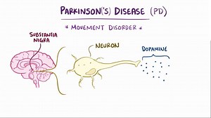 Video: Parkinson disease - Video Explanation! | Osmosis | Osmosis