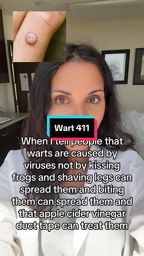 Understanding Warts: Causes and Spread Explained