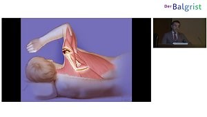 Lower Trapezius Tendon Transfer: Biomechanics, Indications and Techniques