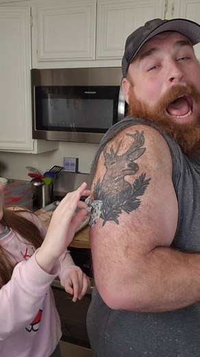 4.3M views · 10K reactions | How the turntables have... I gave Lillian the chance to pull a sticker off my arm for once (i have hair and she doesnt - but she is still brave for enduring putting her Dexcom and sticker on and removing them every 10 days. #diabetes #t1d #typeonediabetes #dexcom #dexcomg6 #expressionmed | Clinton Svatos | Facebook