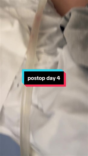 postop day 4 #fyp #surgery #update #vlog | surgery