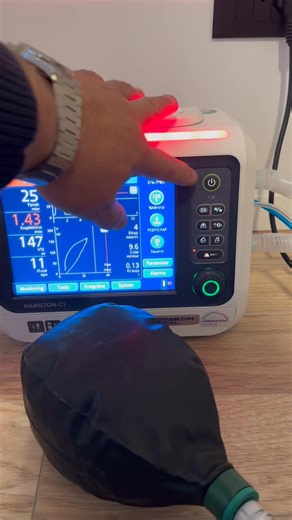 ✅ Çfarë është ASV (Adaptive Support Ventilation) te Hamilton C1? ASV është një modalitet inteligjent i ventilimit që rregullon automatikisht frymëmarrjen e pacientit bazuar në: • peshën e parashikuar trupore (PBW) • mekanikën e mushkërive (rezistencë & kompliancë) • spontanitetin e frymëmarrjes • nivelin e kërkuar të ventilimit (%MinVol) ASV llogarit në mënyrë dinamike frekueshmërinë e frymëmarrjes, volumin tidal dhe presionin e nevojshëm, duke optimizuar ventilimin pa ndërhyrje të shpeshtë manu