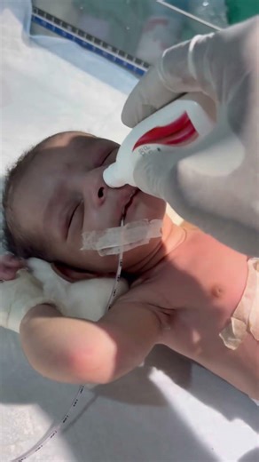 Chestryped for newborn baby😌 #sumitnicunursingstm #youtubeshorts #nursin #newbornbaby #chestworkout