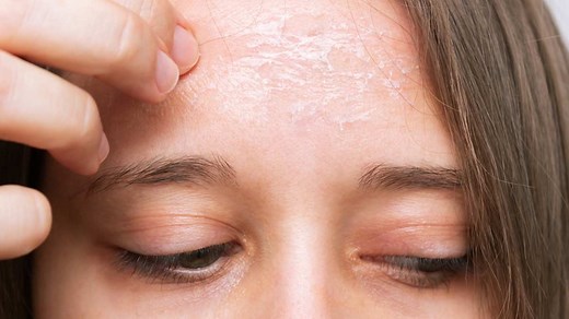 Skin Pilling: Expert Explains What It Is, Its Causes, And Preventive Tips