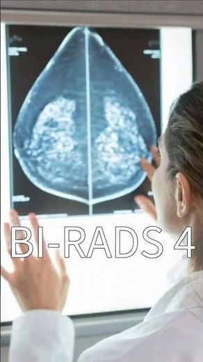 BI-RADS 4: o que fazer diante dessa alteração do exame de imagem da mama? #mastologia #mastologista