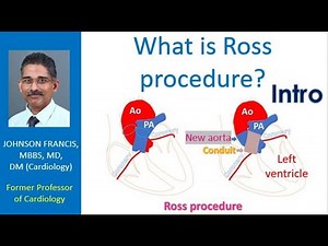 What is Ross procedure? Intro