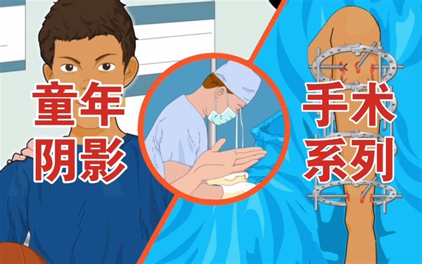 极度真实、被迫下架的“手术”小游戏【腿部手术/手术系列（Operate Now: Leg Surgery）】