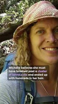 Warning for Aussies after 600 parasites removed from woman’s skin | #yahoonewsau