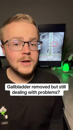 If your gallbladder is gone but you’re still dealing with bloating, reflux, loose stools, nausea, right-side discomfort, or trouble tolerating fats — you’re not crazy, and you’re not broken. Your gallbladder wasn’t just “extra.” It played a major role in bile storage, timing, and fat digestion. When it’s removed, bile flow changes — and that can stress your gut, liver, microbiome, hormones, and inflammation pathways. 🚨 Surgery removes the organ, not the dysfunction. The real question is: 👉 Is 