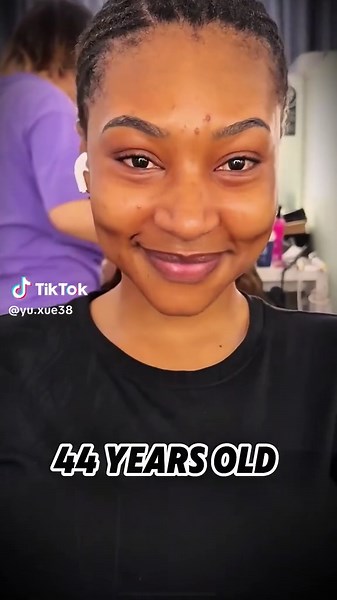 I use a bespoke small-incision mini-facelift — not a full open facelift, not threadlifting — to lift and redefine the lower face while preserving natural expression. The technique and structured aftercare aim to reduce swelling and shorten downtime; candidacy is assessed individually. DM photos for a quick suitability check. Results may vary. #MiniFacelift #Facelift #Jawline #AntiAging #facialrejuvenation