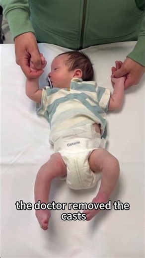 This baby was born with congenital defects in both legs.