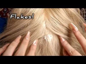 ASMR Scalp Inspection & Dandruff Removal🔍✨|No talking