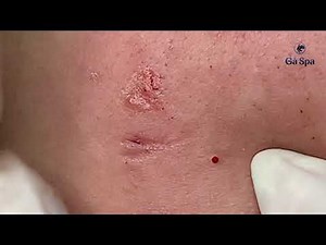 SIGNATURE SERVICE - PART 2