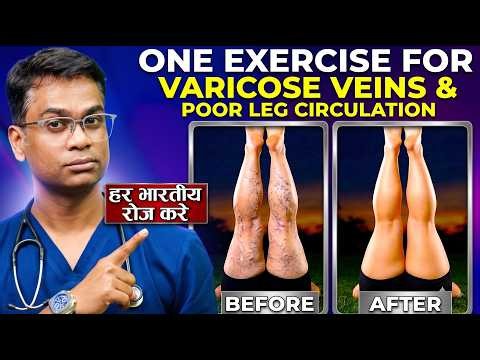 Varicose Vein Relief — A Quick 5-Minute Evening Ritual for Heavy, Tired Legs