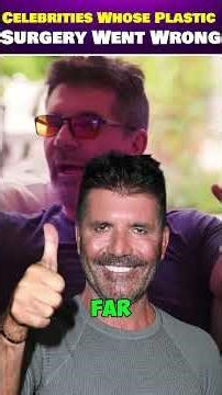 Plastic Surgery Disasters You Won’t Believe 😱💉 #PlasticSurgeryGoneWrong #CelebrityTransformations