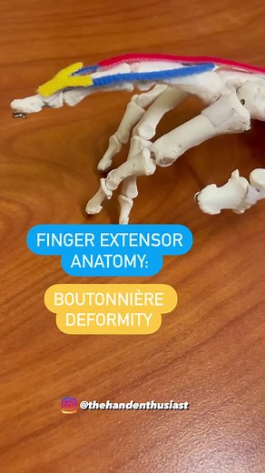 Understanding Finger Extensor Anatomy and Boutonnière Deformity