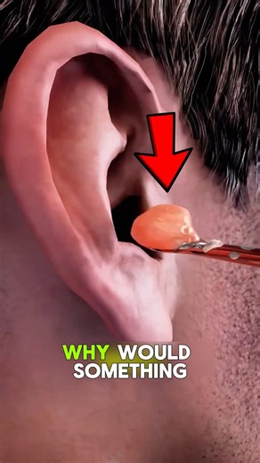“This Ear Was 100% Blocked! Watch This 😳👂”