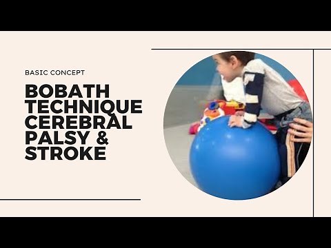 Basic idea in Bobath Approach for the management of cerebral palsy and adult stroke #bobath