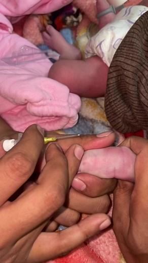 Iv cannula technique in newborn . #shortsviral #project #nursery #doctors | Barkat Choudhry