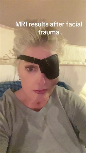 Understanding MRI Results After Facial Trauma