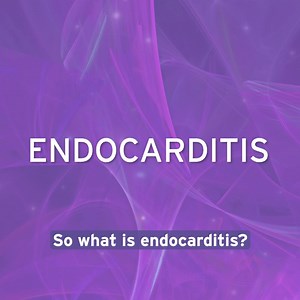 Did you know you can get a serious heart infection after routine dental work? Chief of Cardiac Surgery Douglas R. Johnston, MD, explains. #Endocarditis #HeartHealth #CardiacSurgery #Surgeon | Bluhm Cardiovascular Institute
